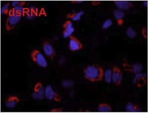Figure 2. Immunofluorescence microscopy using J2 antibody reveals dsRNA (labelled in red), a marker for the the viral replication complex, in HuH-7 cells infected with Dengue virus. Cellular DNA is labelled with DAPI (blue). Figure taken from Anwar et al. (2011) PLoS One 6:e23246.